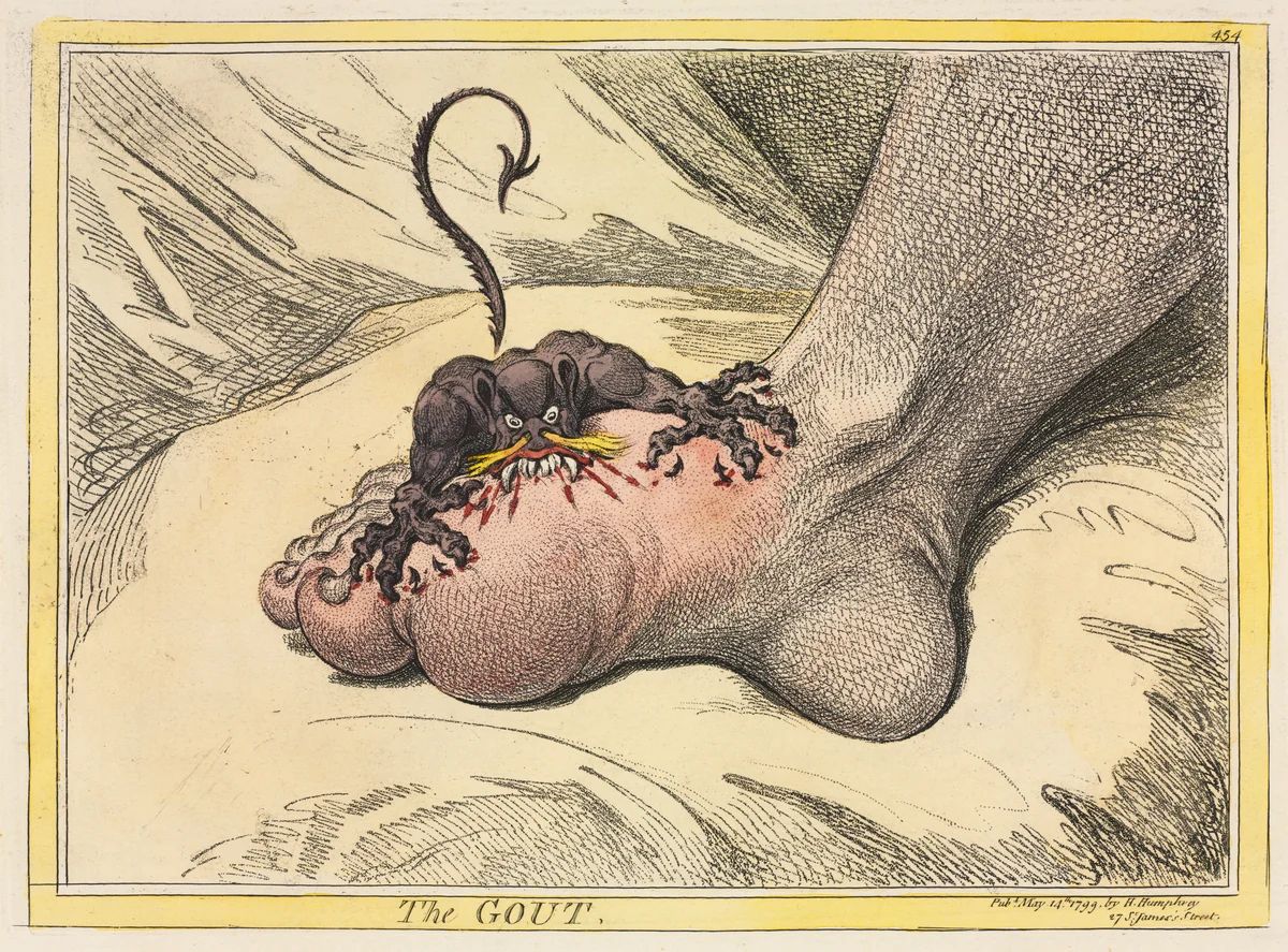 The Gout by James Gillray, print, 1799