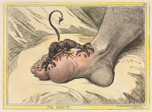 The Gout by James Gillray, print, 1799