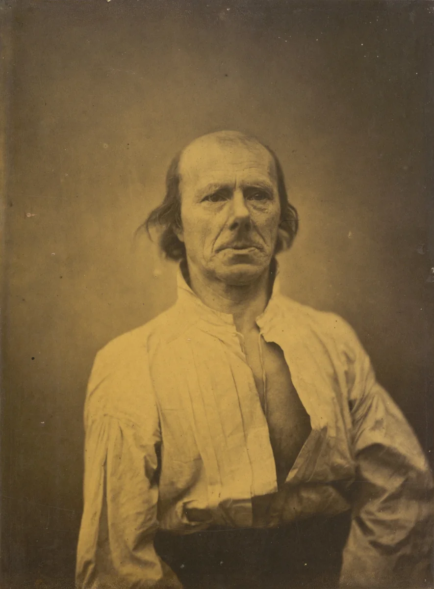 Face in repose by Guillaume-Benjamin-Amant Duchenne, photograph, 1854-1856