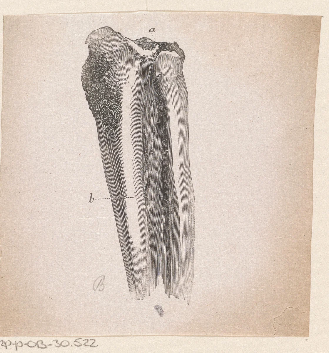 Menselijk bot met een afwijking by Isaac Weissenbruch, print, 1836-1912