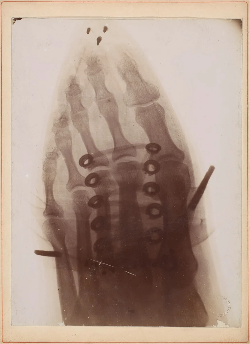 Le pied à travers la chaussure by Henri van Heurck, photograph, 1896
