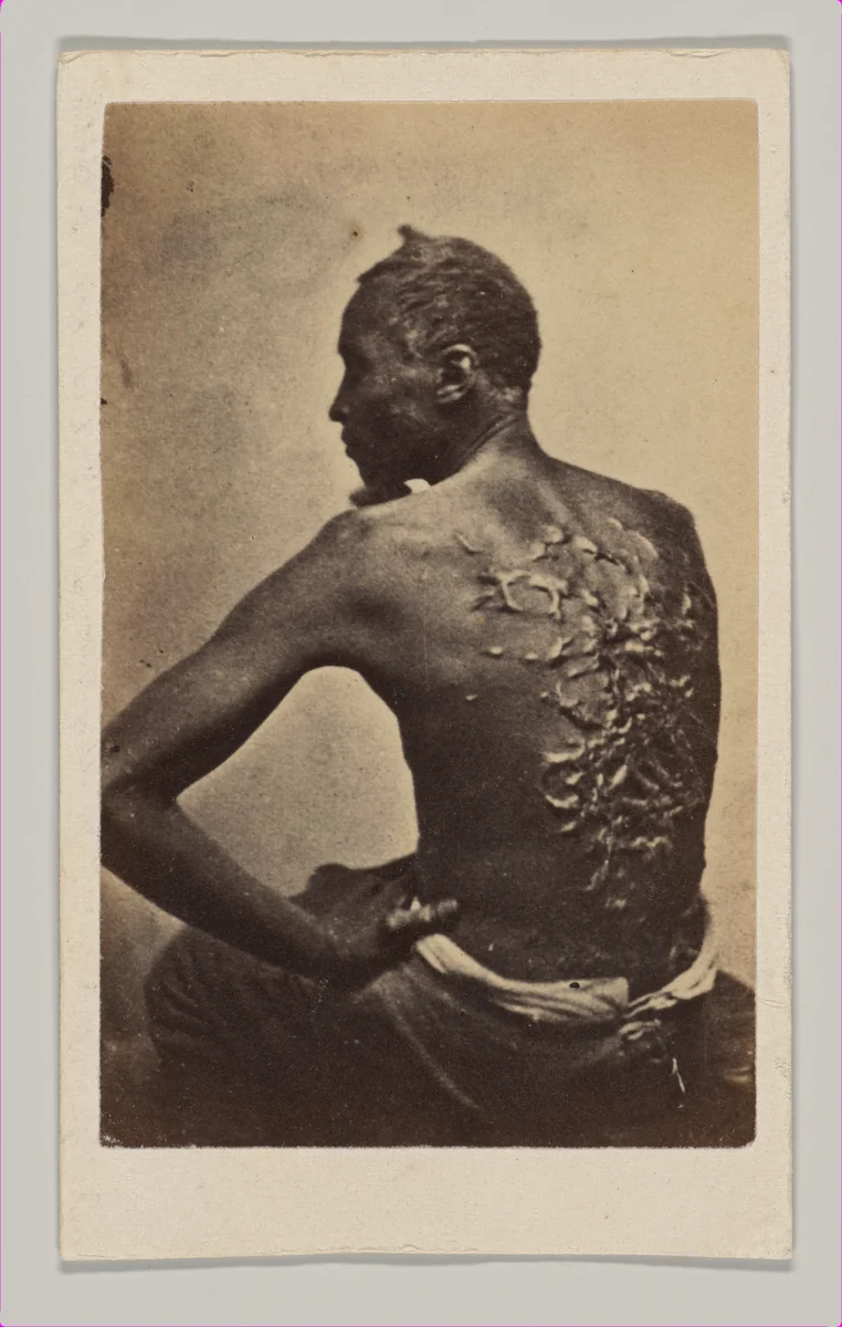 Gordon, A Runaway Mississippi Slave, or "The Scourged Back" by McPherson & Oliver, photograph, 1863