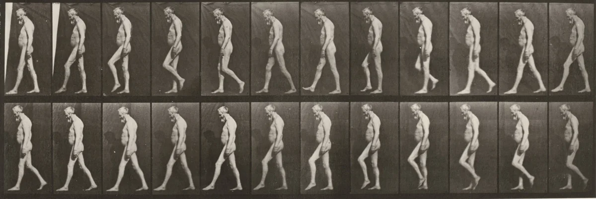 Plate Number 555. Muscular atrophy of legs, adult, walking by Eadweard Muybridge, photograph, 1887