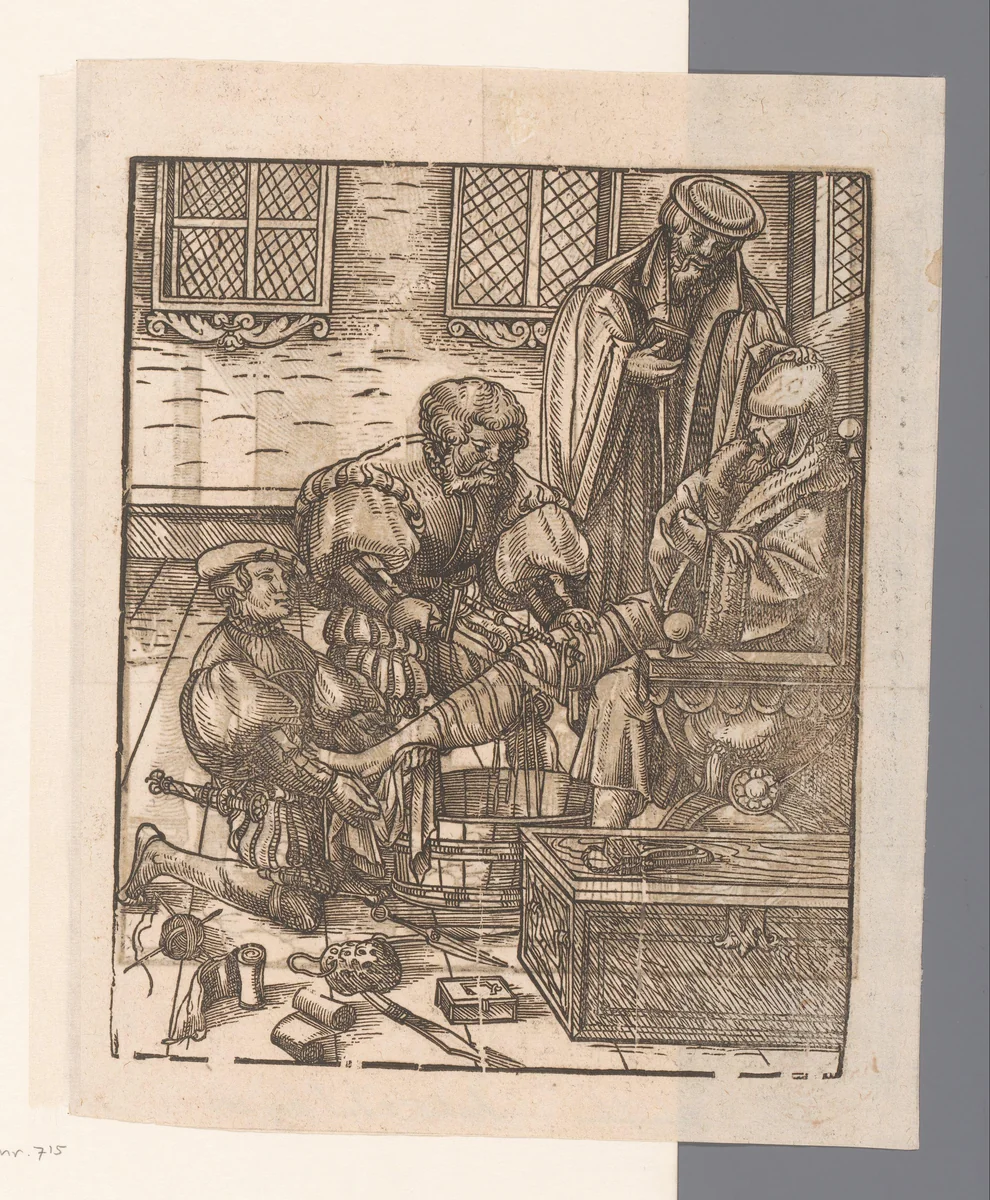 Beenamputatie by anonymous, print, 1500-1550