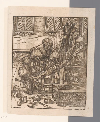 Beenamputatie by anonymous, print, 1500-1550