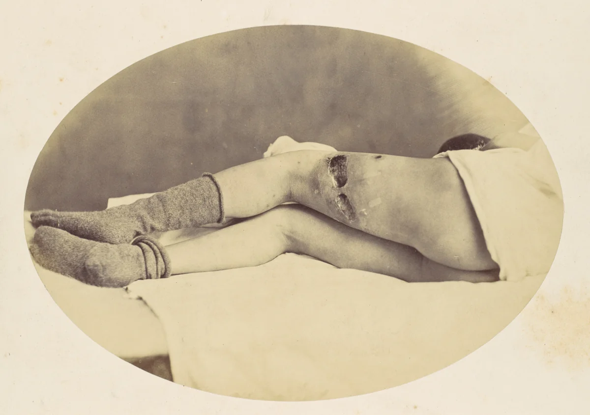 Judson C. Albright by Reed Bontecou, photograph, 1865