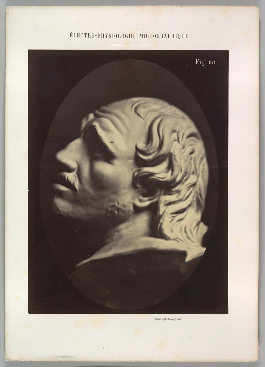 Figure 66: Head of Arrotino (the spy, the knife grinder, and so on) by Guillaume Benjamin Amand Duchenne de Boulogne, photograph, 1854-1856