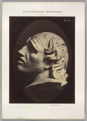 Figure 66: Head of Arrotino (the spy, the knife grinder, and so on) by Guillaume Benjamin Amand Duchenne de Boulogne, photograph, 1854-1856