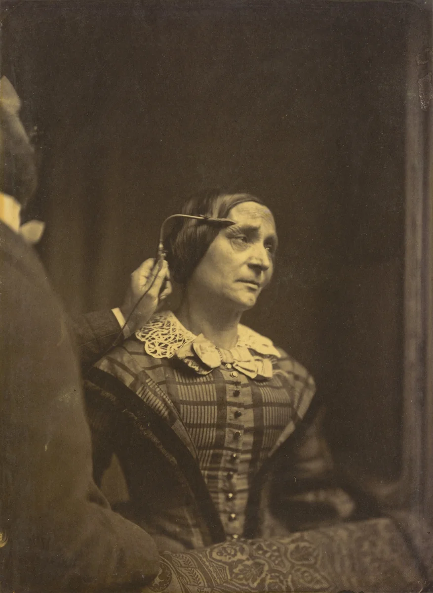 Attention, attentive gaze (left); Painful attention (right) by Guillaume-Benjamin-Amant Duchenne, photograph, 1854-1856
