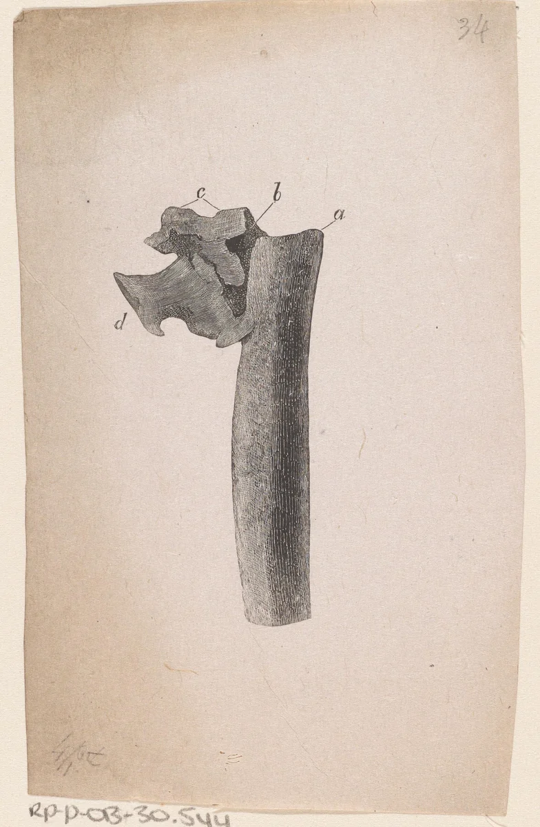 Menselijk bot met een afwijking by Isaac Weissenbruch, print, 1836-1912