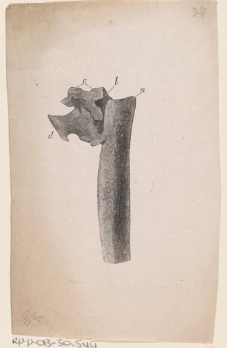 Menselijk bot met een afwijking by Isaac Weissenbruch, print, 1836-1912