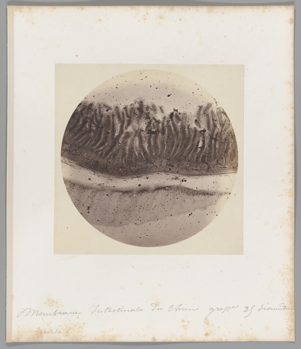 Membrane Intestinale du chien grosse [Membrane of a Dog’s Intestine] by Auguste-Adolphe Bertsch, photograph, 1853-1857