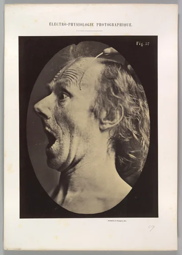 Figure 57: Astonishment, stupefaction, amazement by Guillaume Benjamin Amand Duchenne de Boulogne, photograph, 1854-1856
