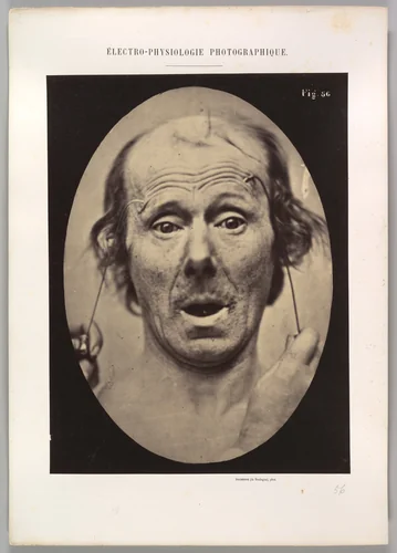 Figure 56: Surprise by Guillaume Benjamin Amand Duchenne de Boulogne, photograph, 1854-1856