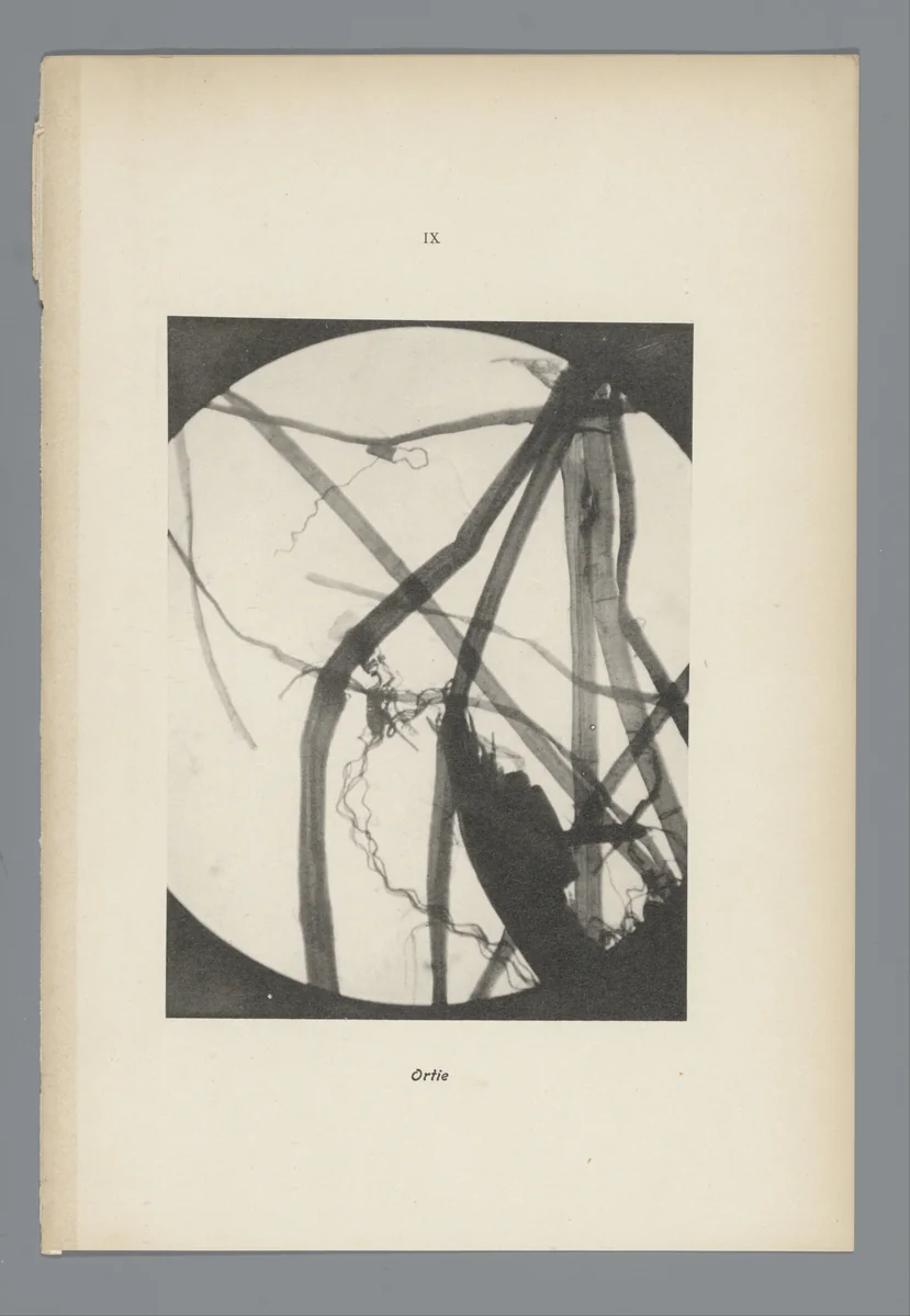 Microfoto’s van papiervezels by anonymous, photograph, 1900