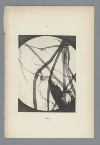 Microfoto’s van papiervezels by anonymous, photograph, 1900