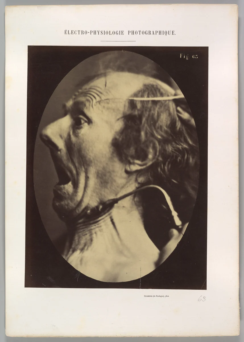 Figure 63: Expression of terror by Guillaume Benjamin Amand Duchenne de Boulogne, photograph, 1854-1856