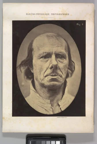 Figure 3: The face of an old man... photographed in repose. by Guillaume Benjamin Amand Duchenne de Boulogne, photograph, 1854-1856