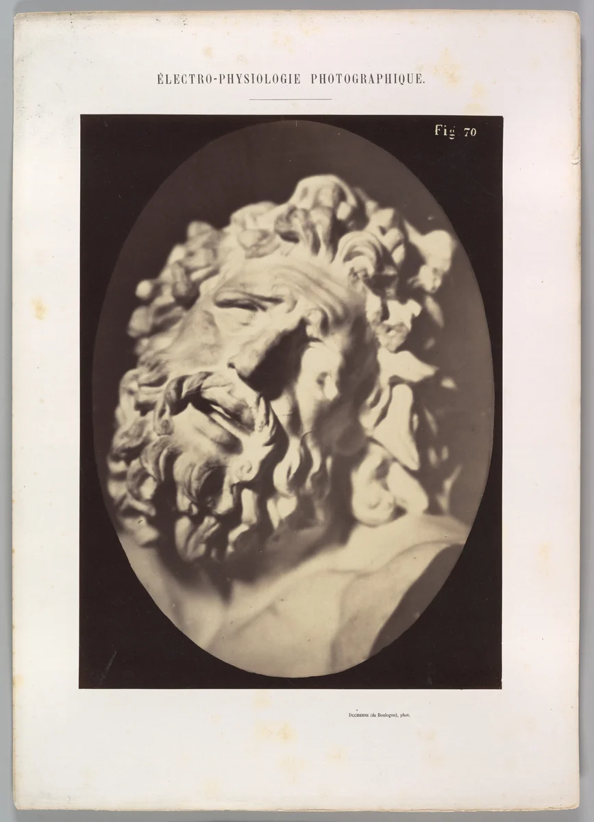 Figure 70: Head of the Laocoön of Rome by Guillaume Benjamin Amand Duchenne de Boulogne, photograph, 1854-1856