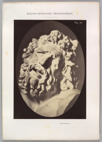 Figure 70: Head of the Laocoön of Rome by Guillaume Benjamin Amand Duchenne de Boulogne, photograph, 1854-1856