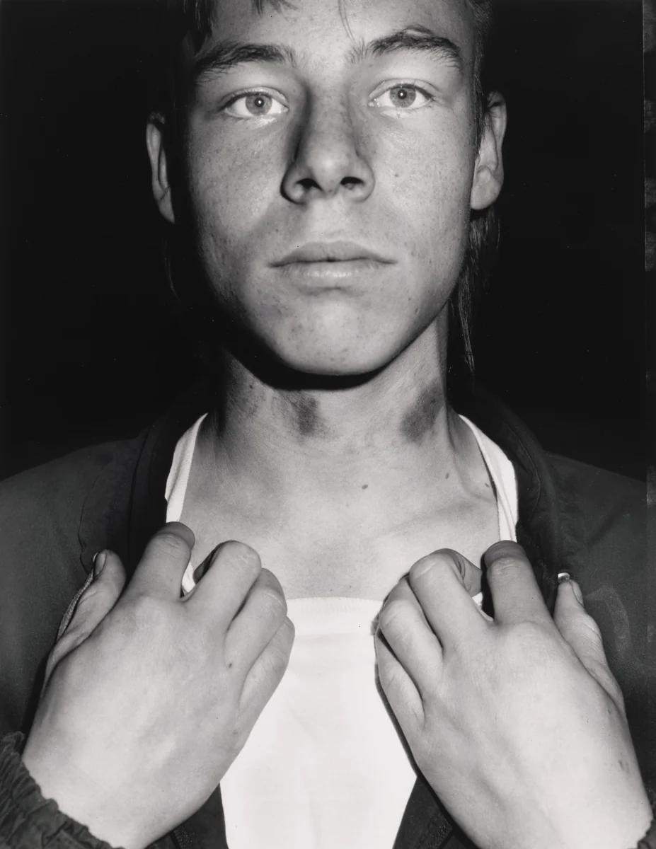 Hickeys by Jim Goldberg, photograph, 1989