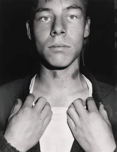 Hickeys by Jim Goldberg, photograph, 1989