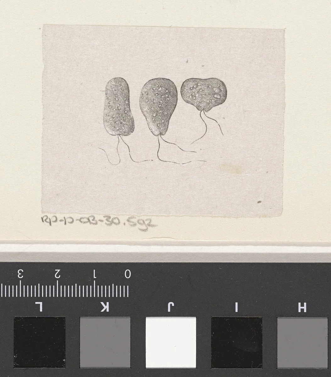 Onderdeel van het menselijk lichaam met een afwijking by Isaac Weissenbruch, print, 1836-1912