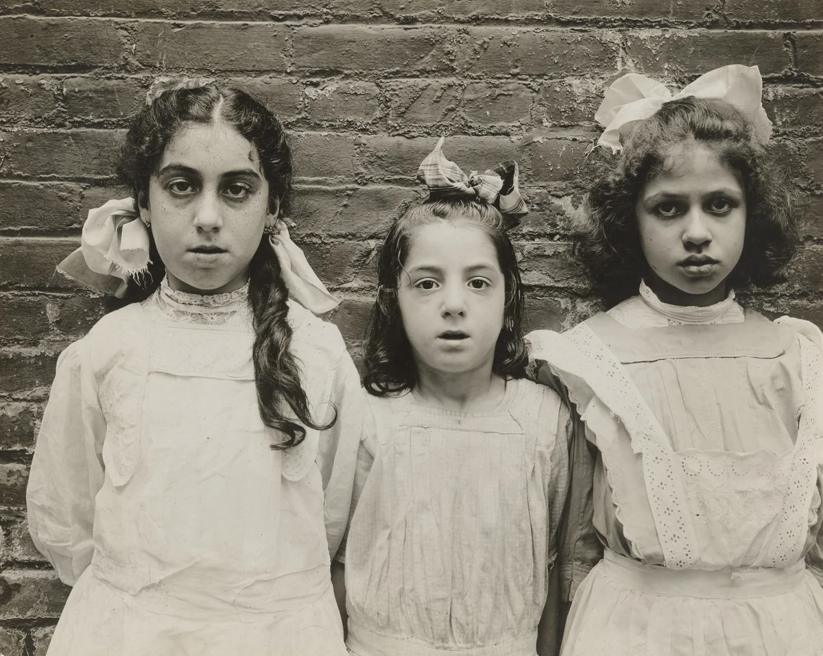 Physically Defective Children by Jessie Tarbox Beals, photograph, 1910
