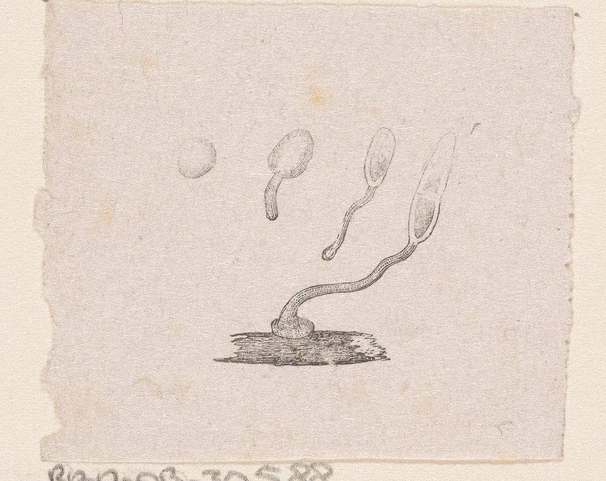 Onderdeel van het menselijk lichaam met een afwijking by Isaac Weissenbruch, print, 1836-1912