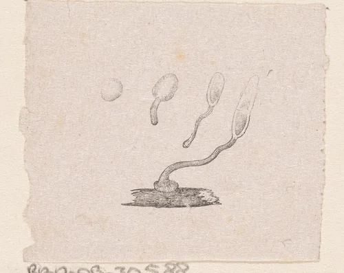 Onderdeel van het menselijk lichaam met een afwijking by Isaac Weissenbruch, print, 1836-1912