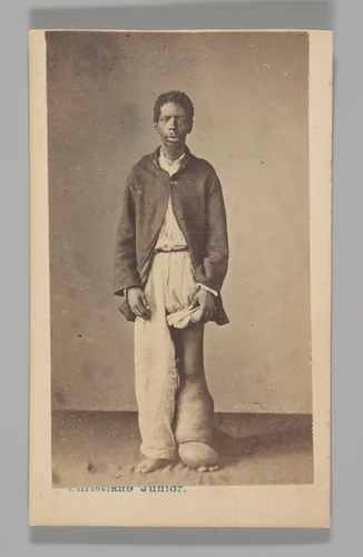 [Studio Portrait: Man Standing with Swollen Leg and Foot Caused by Elephantiasis, Brazil] by Christiano Junior, photograph, 1864-1866