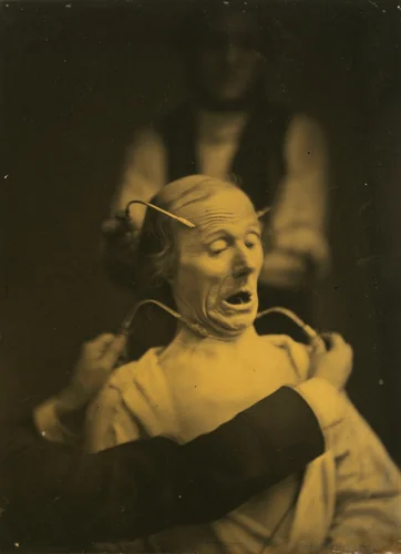 Expression of terror by Guillaume-Benjamin-Amant Duchenne, photograph, 1854-1856