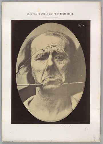 Figure 45: Pain and despair. by Guillaume Benjamin Amand Duchenne de Boulogne, photograph, 1854-1856