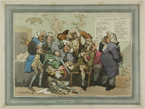 Amputation by Thomas Rowlandson, print, 1793