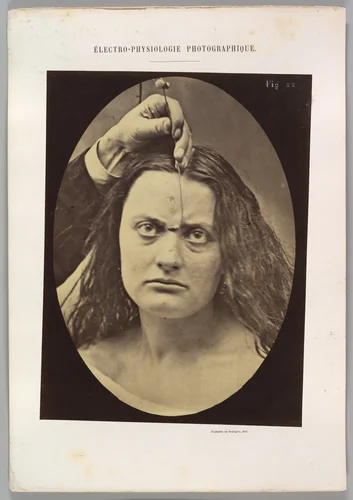 Figure 82: Lady Macbeth, strong expression of cruelty by Guillaume Benjamin Amand Duchenne de Boulogne, photograph, 1854-1856