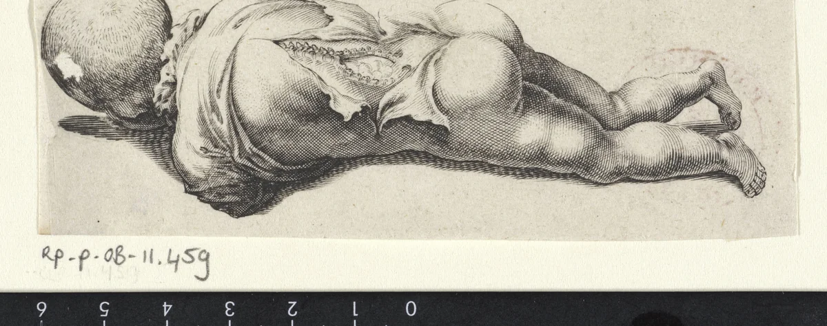 Opengesneden lichaam van een kind met een open rug by anonymous, print, 1617-1727