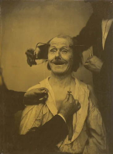 A false, incomplete expression of agreeable surprise, or admiration by Guillaume-Benjamin-Amant Duchenne, photograph, 1854-1856