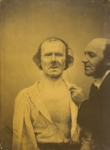 Weeping, tears of pity (left); Relaxed face (right) by Guillaume-Benjamin-Amant Duchenne; Adrien Tournachon, photograph, 1854-1856