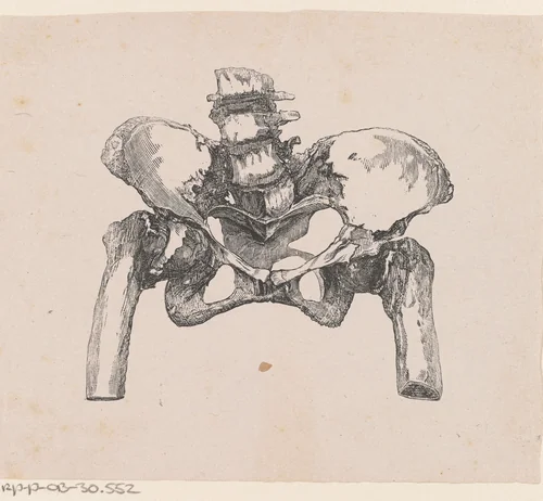 Menselijk bekken met een afwijking by Isaac Weissenbruch, print, 1836-1912
