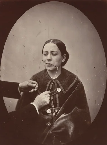 Plate 36 from the chapter The muscles of Joy and Benevolence by Guillaume Duchenne de Boulogne, Adrien Tournachon, photograph, 1856