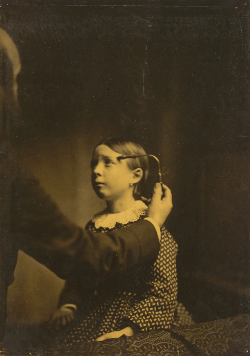 Painful memories by Guillaume-Benjamin-Amant Duchenne, photograph, 1854-1856