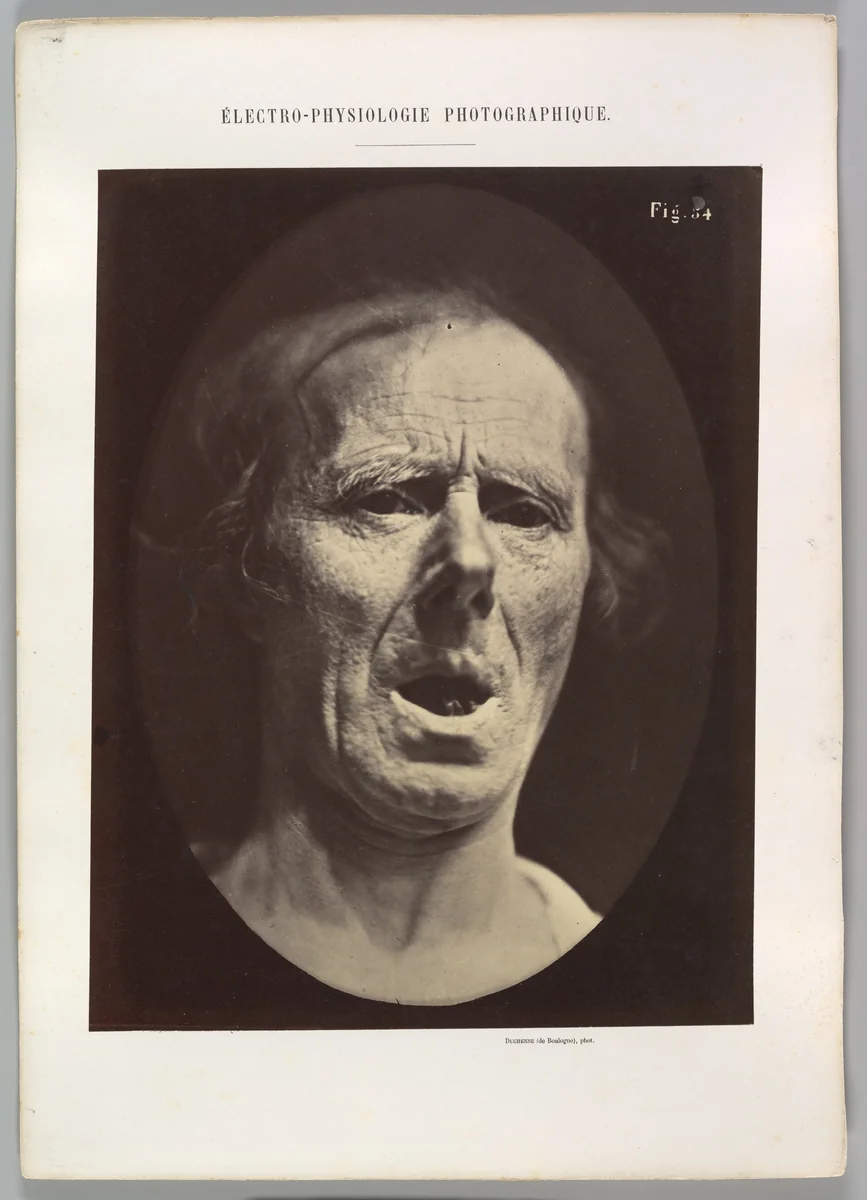 Figure 54: Voluntary lowering of the lower jaw by Guillaume Benjamin Amand Duchenne de Boulogne, photograph, 1854-1856
