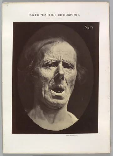 Figure 54: Voluntary lowering of the lower jaw by Guillaume Benjamin Amand Duchenne de Boulogne, photograph, 1854-1856