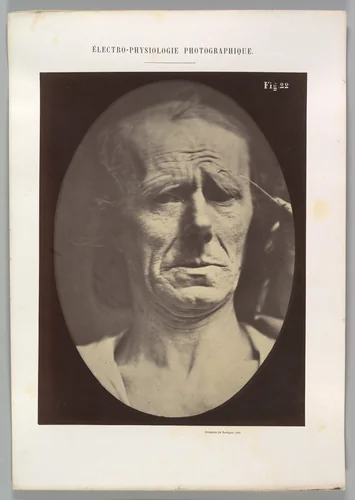 Figure 22: No painful expression by Guillaume Benjamin Amand Duchenne de Boulogne, photograph, 1854-1856