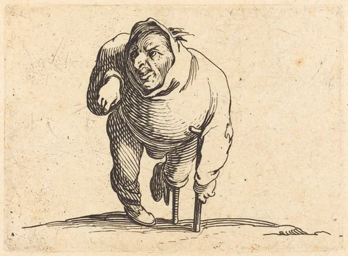 Cripple with Crutch and Wooden Leg by Jacques Callot, print, 1622