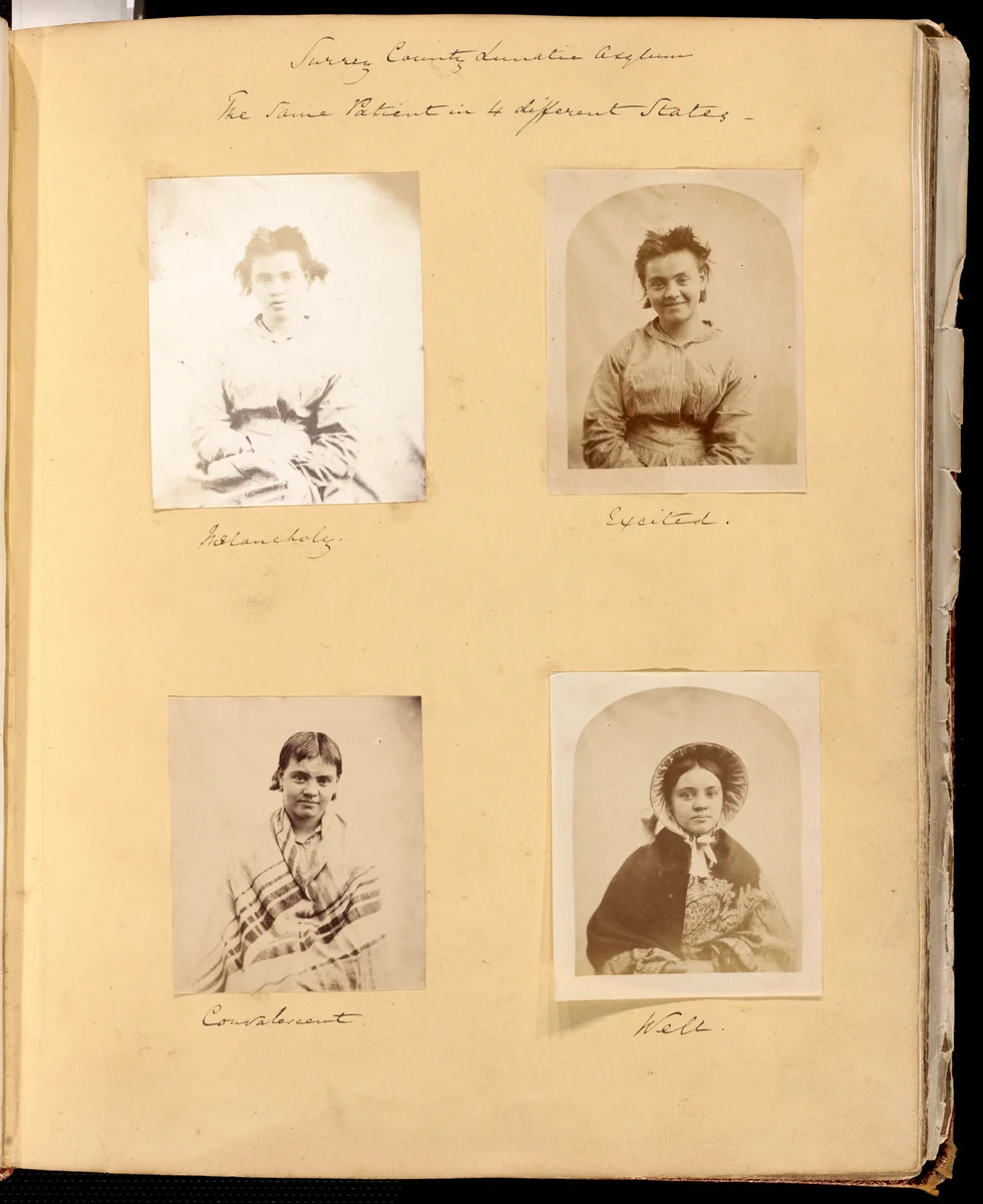 Surrey County Lunatic Asylum, The Same Patient in 4 Different States: Melancholy, Excited, Convalescent, Well Untitled, 1849–60, from the George Cowper Album, assembled 1849–60 by Hugh Welch Diamond, photograph, 1848-1858