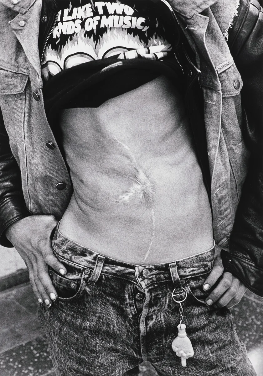 I'm Dave (scar) by Jim Goldberg, photograph, 1987