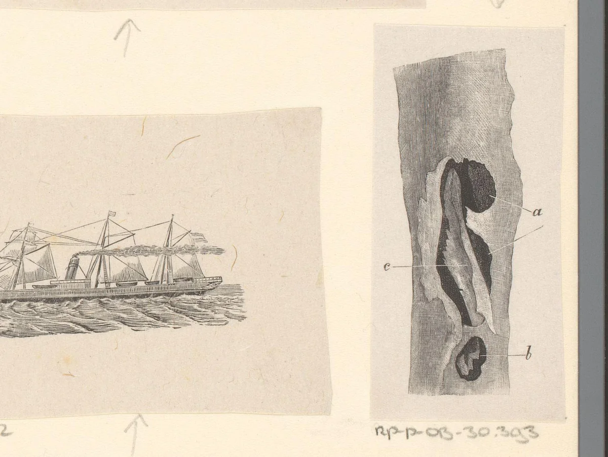 Menselijk bot met een afwijking by Isaac Weissenbruch, print, 1836-1912