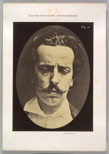 Figure 15: Mediation, mental concentration by Guillaume Benjamin Amand Duchenne de Boulogne, photograph, 1854-1856