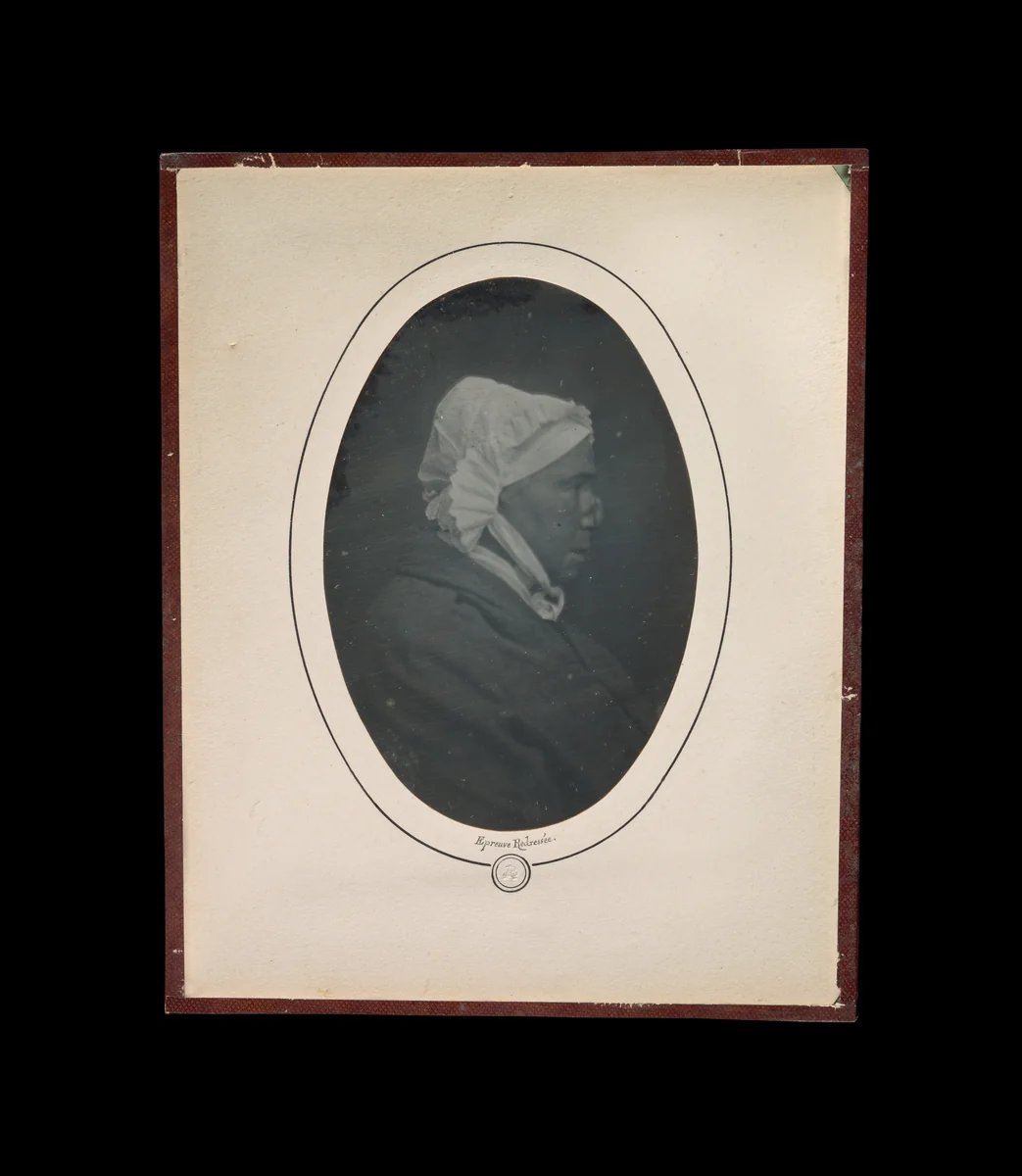 [Profile of a Woman with Necrosis of the Nose] by Louis-Auguste Bisson, photograph, 1841-1848